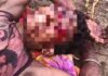बीजापुर में भालू का हमला, युवक गंभीर घायल